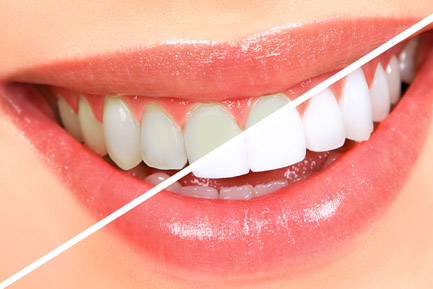 Best Cosmetic Dentist in Pimpri Chinchwad Best Cosmetic Dentist in Pimpri Chinchwad Pune